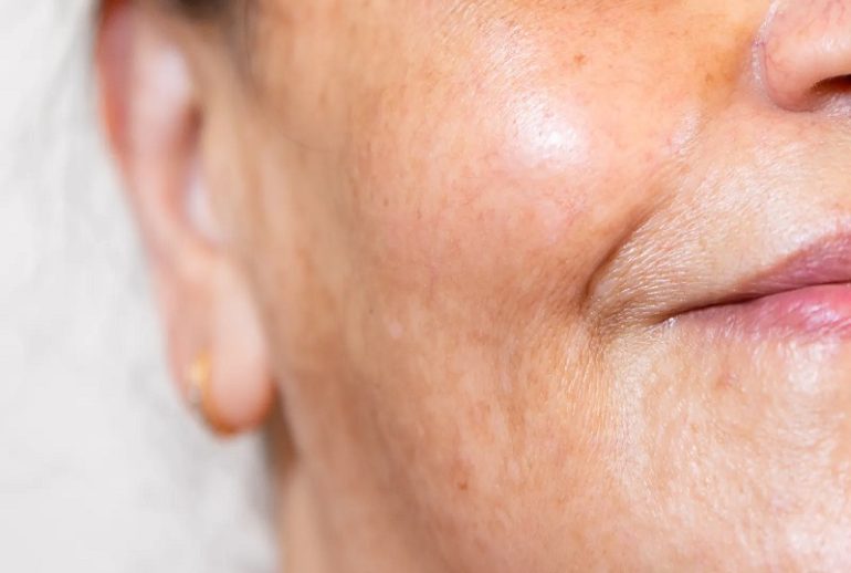 دکتر ملاسما - کرج